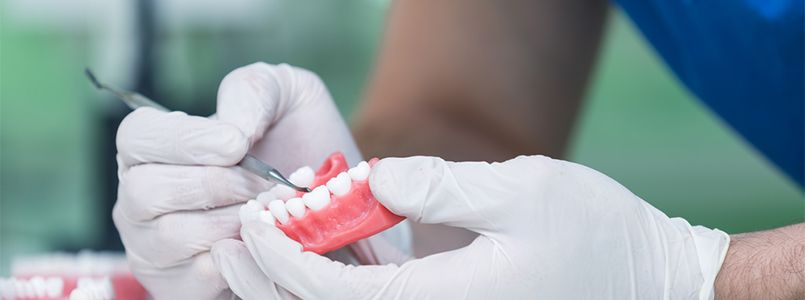 Prothese Kosten: Wie viel kostet eine Prothese?