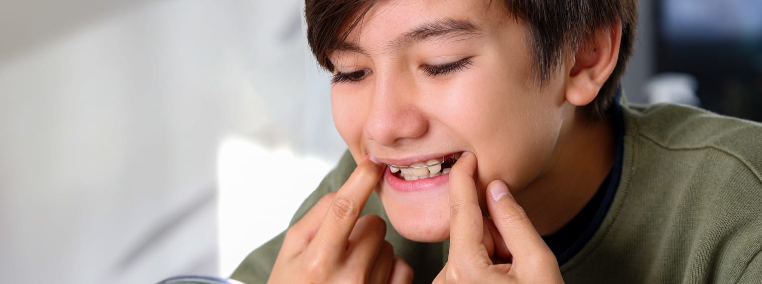 Ein Junge setzt eine herausnehmbare Zahnspange ein.