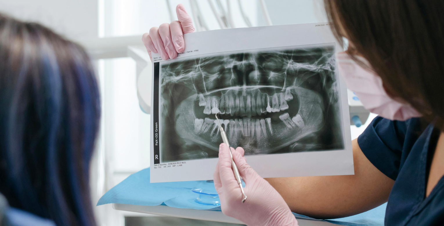 Zahnzusatz­versicherung mit schlechten Zähnen