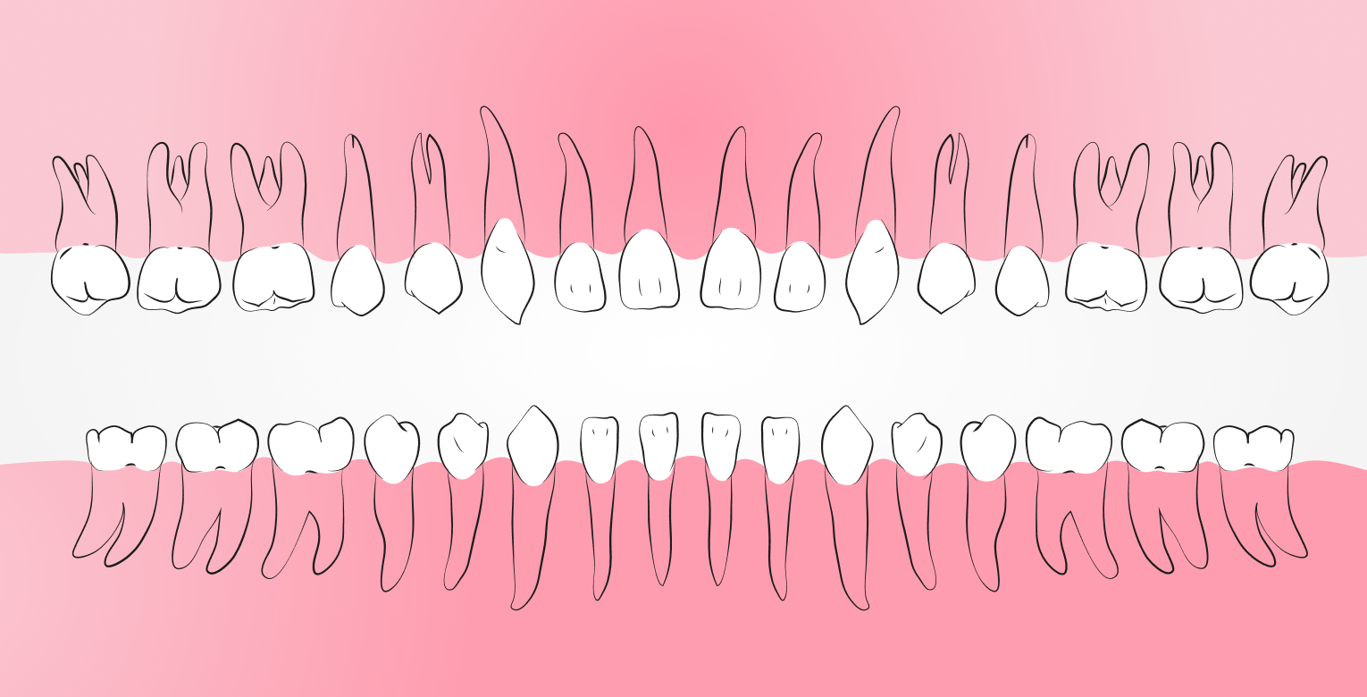 Grafische Nachbildung eines Gebisses