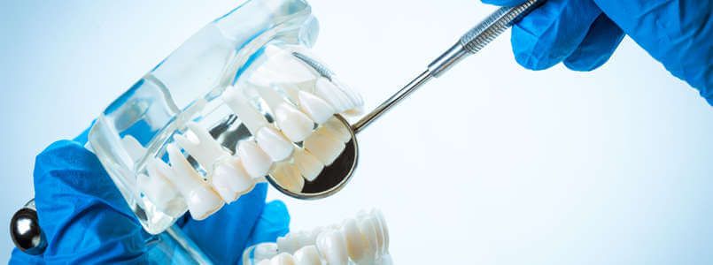 Zu sehen ist ein Schaumodell eines Gebisses mit einem Keramikimplantat.