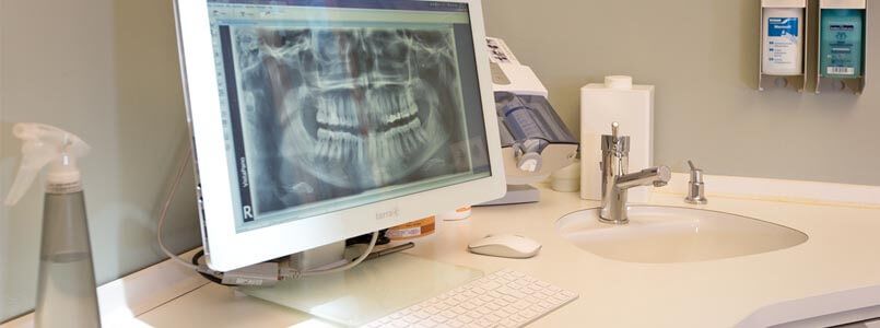 Ein Röntgenbild eines Kiefers mit Zahnimplantaten illustriert, welche gängigen Mythen und Fakten zu Implantaten kursieren.