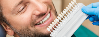 Ein Mann sucht nach der richtigen Farbe für seinen Veneers. Aber was dürfen seine Veneers kosten?